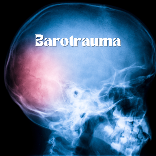 Barotrauma